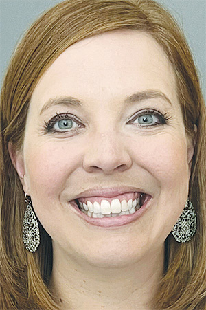Naloxone kiosks are important investment in community